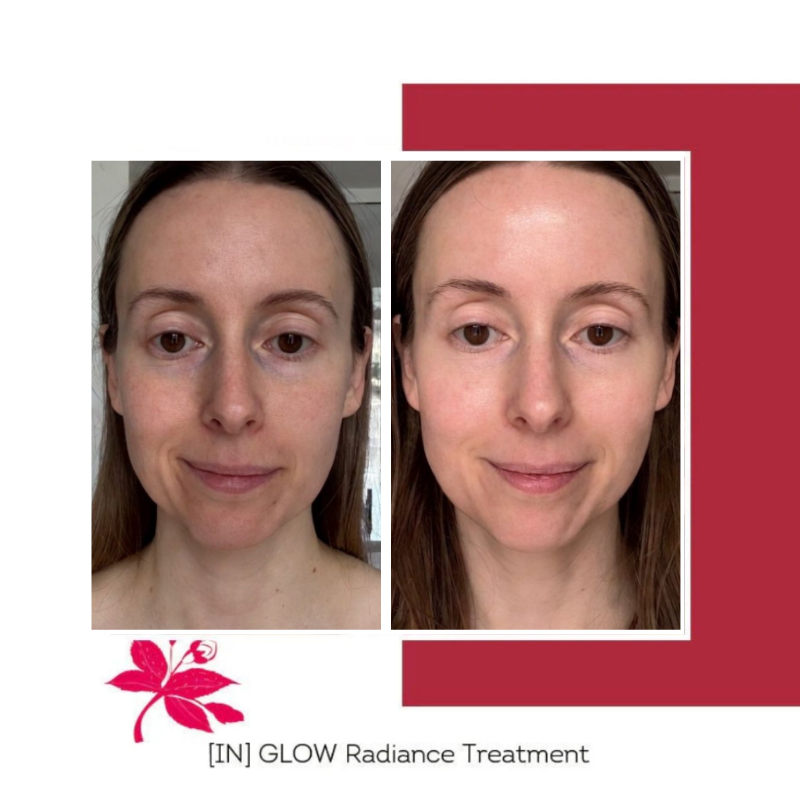 FLORÊVE [IN] GLOW Radiance Cure