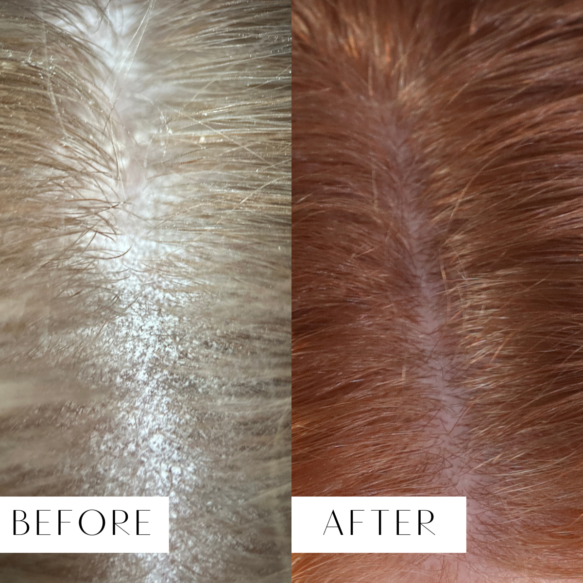 Scalp reboot serum