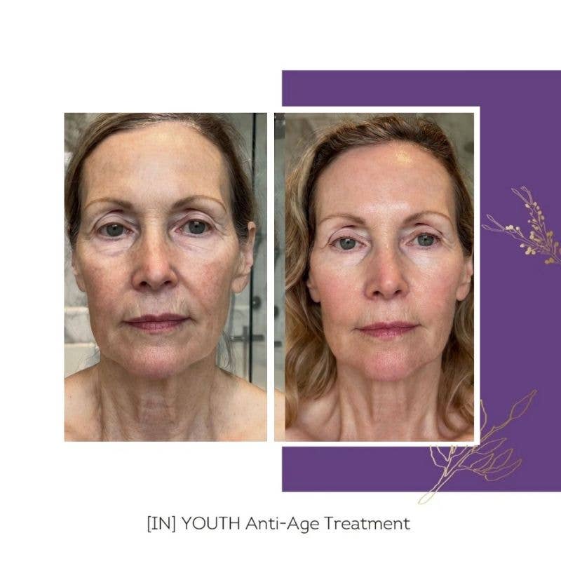FLORÊVE [IN] YOUTH Anti-Aging Cure